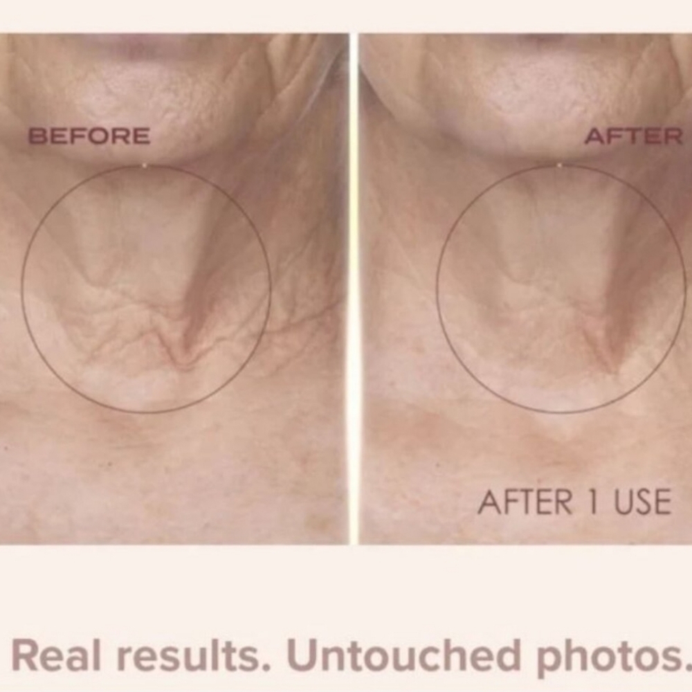 NEW Crêpe Erase Body Serum & Fragrance Free Advanced Body Repair Treatment - Picture 13 of 13